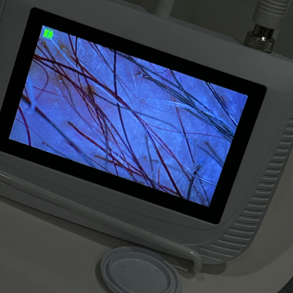 Scalp Analysis + Consultation