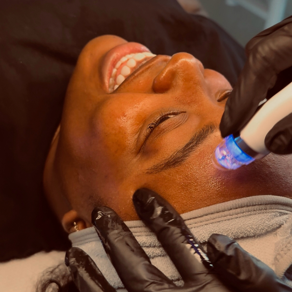 Hydrodermabrasion at Skin by Amile in Oxon Hill, MD