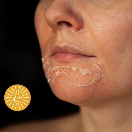 Chemical Exfoliation