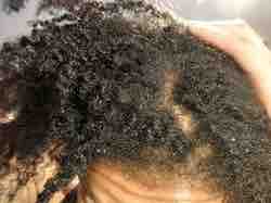 Cornrows Removal & Detangle