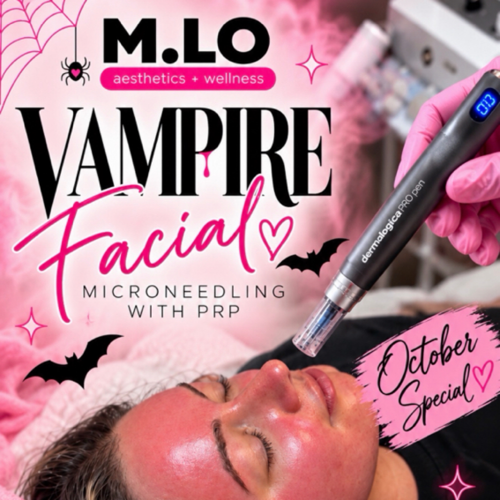Vampire Facial- 1 Session at M.LO aesthetics + wellness in Waukesha, WI