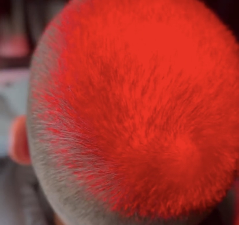 Red Led Light Therapy