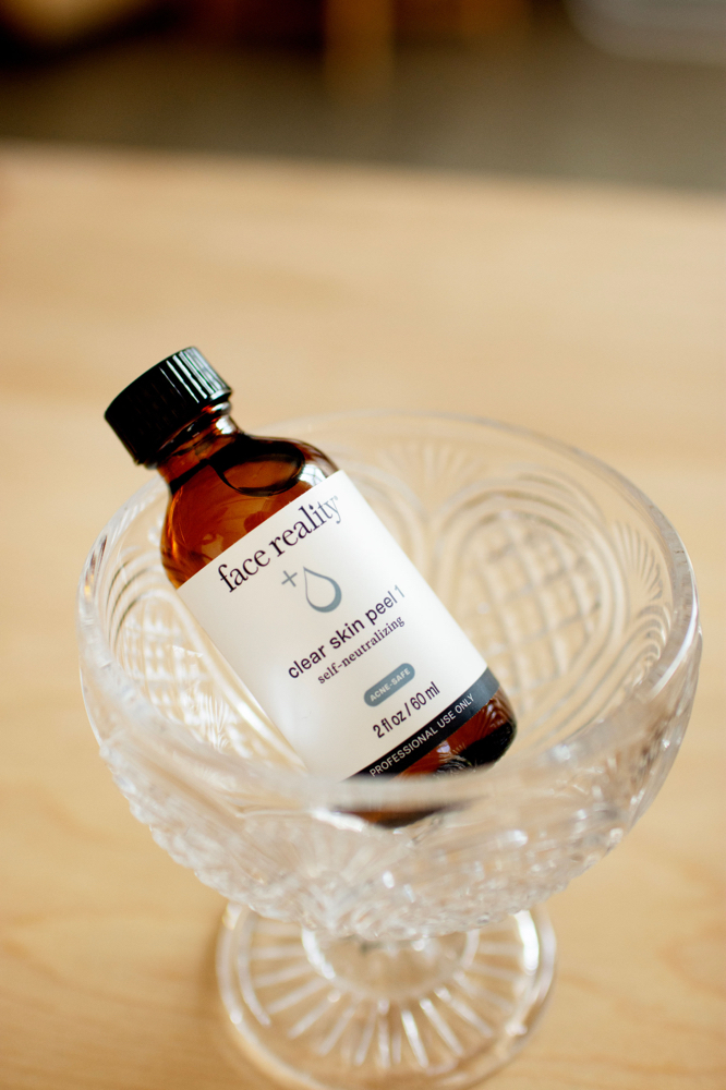 Acne Support Peel Treatment at Timeless Beauty Co in Hagerstown, MD