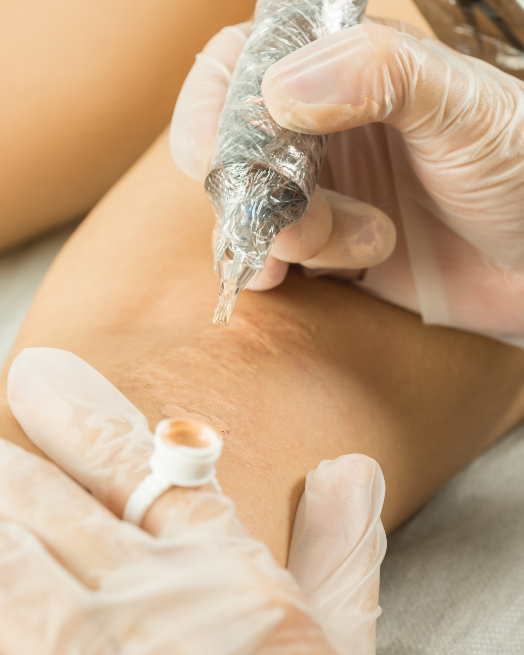 Scar - Camouflage Tattooing