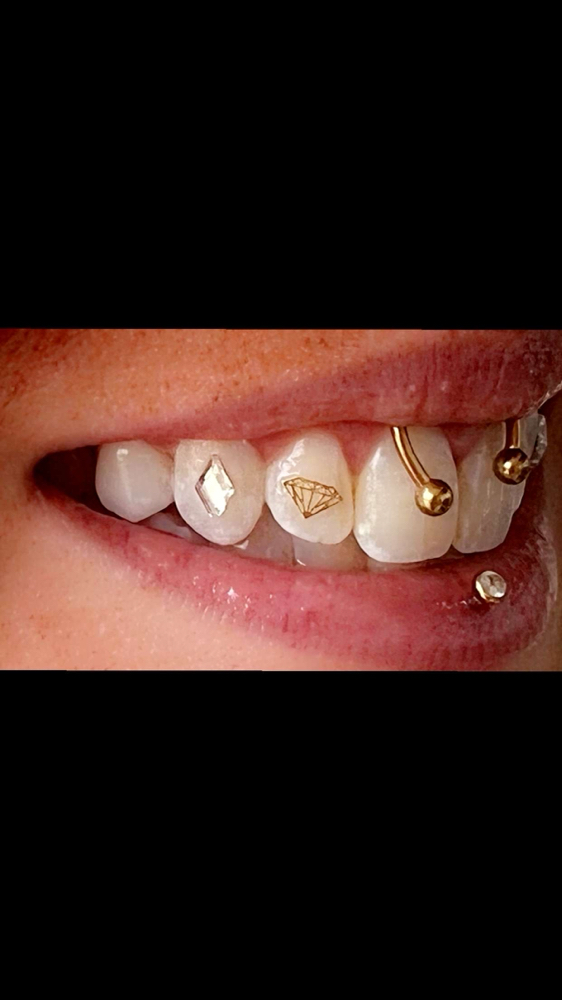 Tooth Gems
