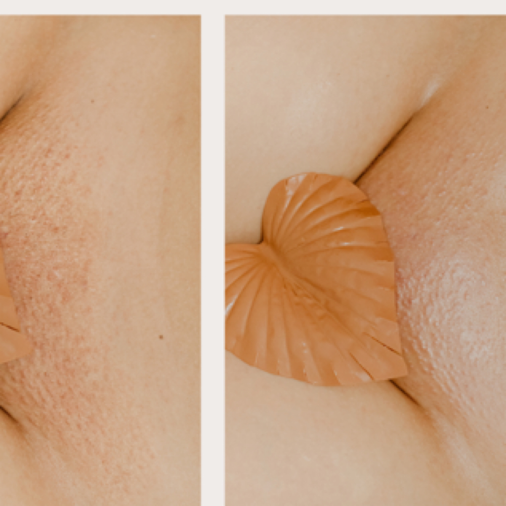 Skin Reset Express Vajacial Mask at Bare RX + Wellness | Full Body Waxing in Midtown Houston in Houston, TX