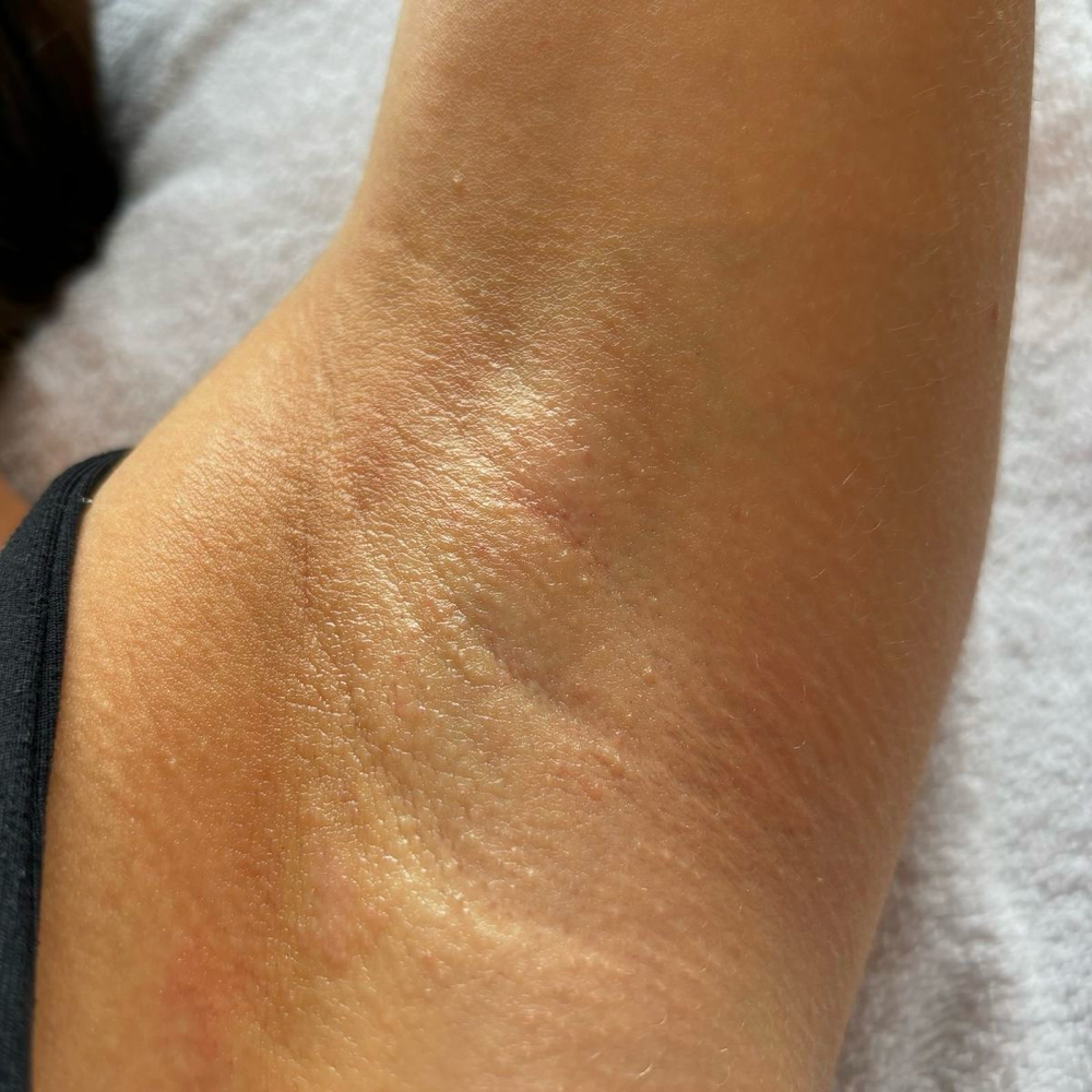 Underarm Wax