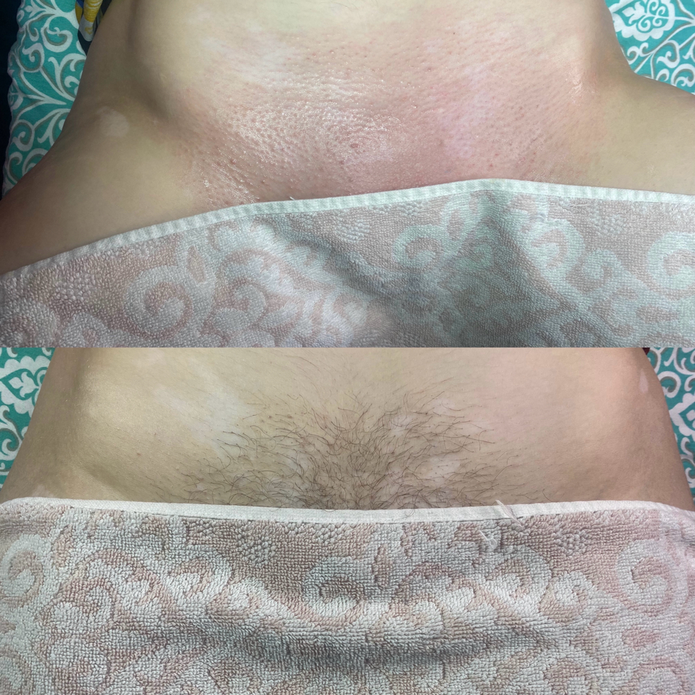 Brazilian Wax