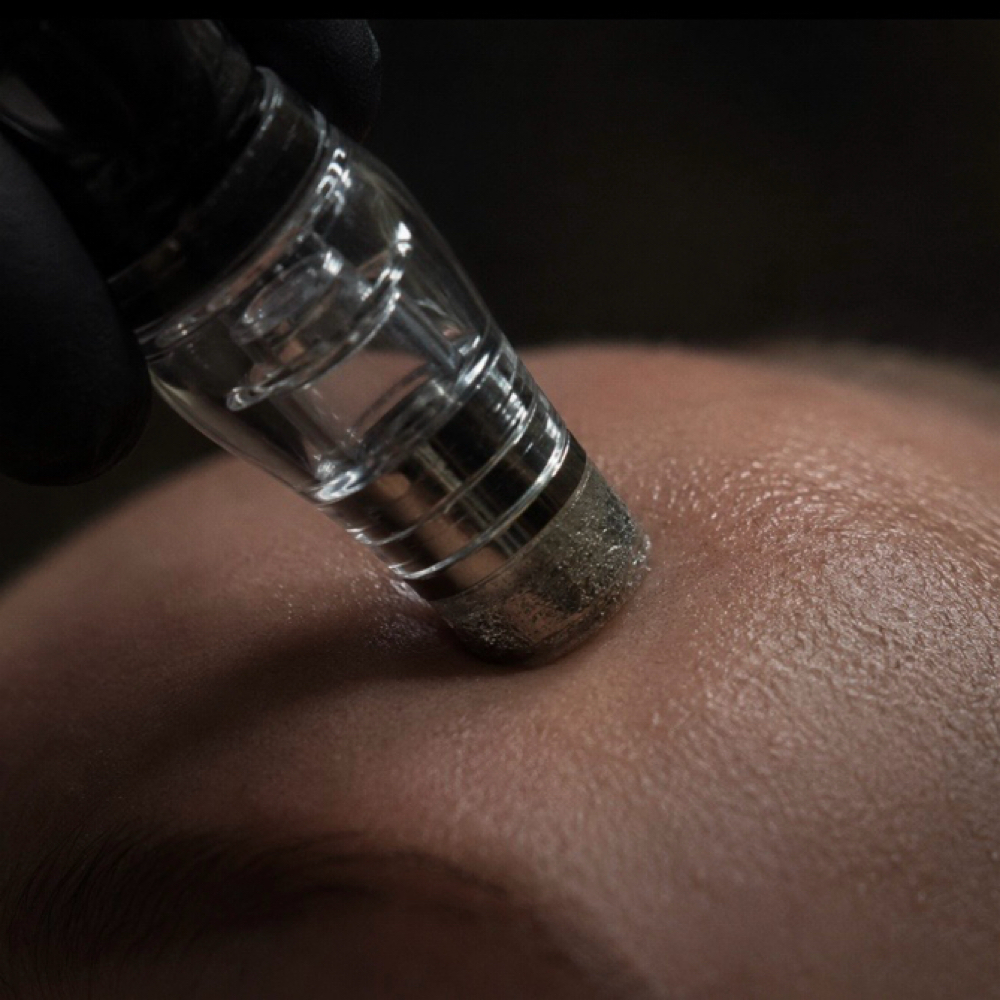 Microdermabrasion Add On at Dark Venom Beauty in St Augustine, FL