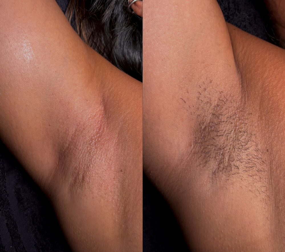Underarm Wax at planet HER in Alexandria, IN