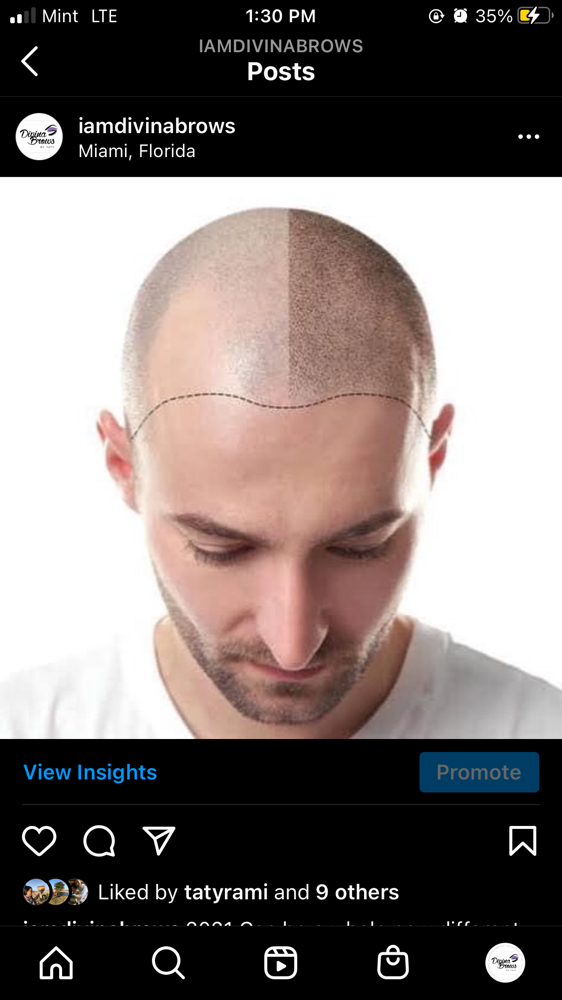 Scalp Pigmentation