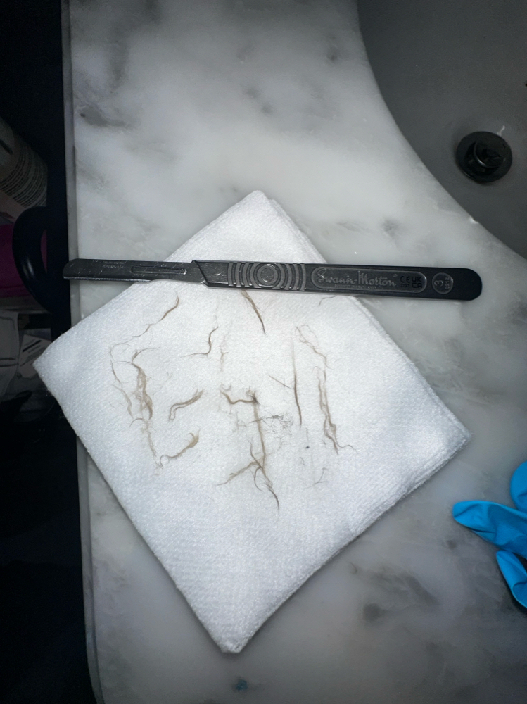 Dermaplane Facial