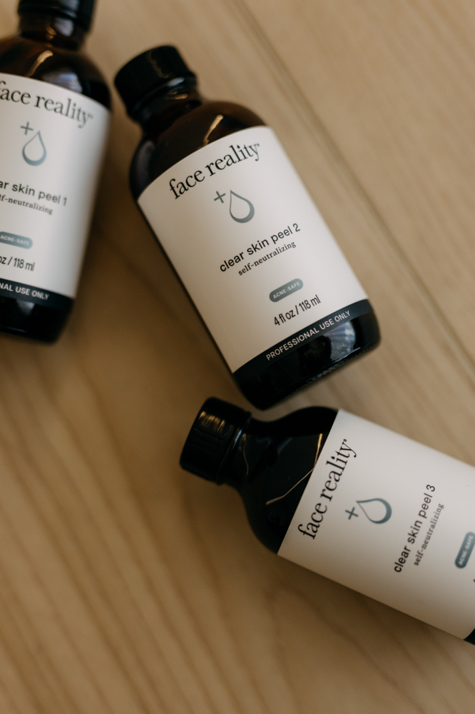Acne Peel
