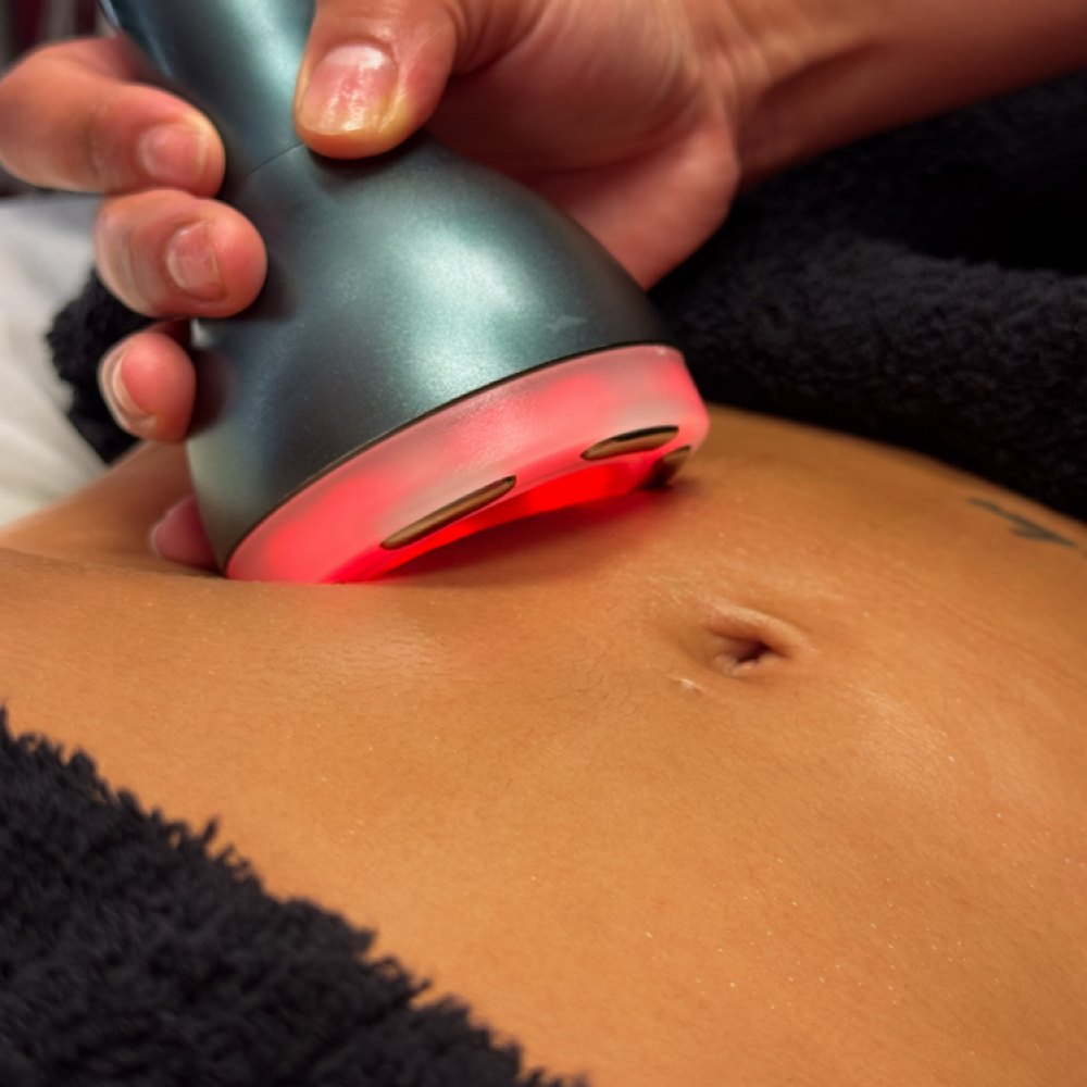 Vacuum Therapy/ Terapia de Vacio at REINA BODY SCULPTING in Chandler, AZ