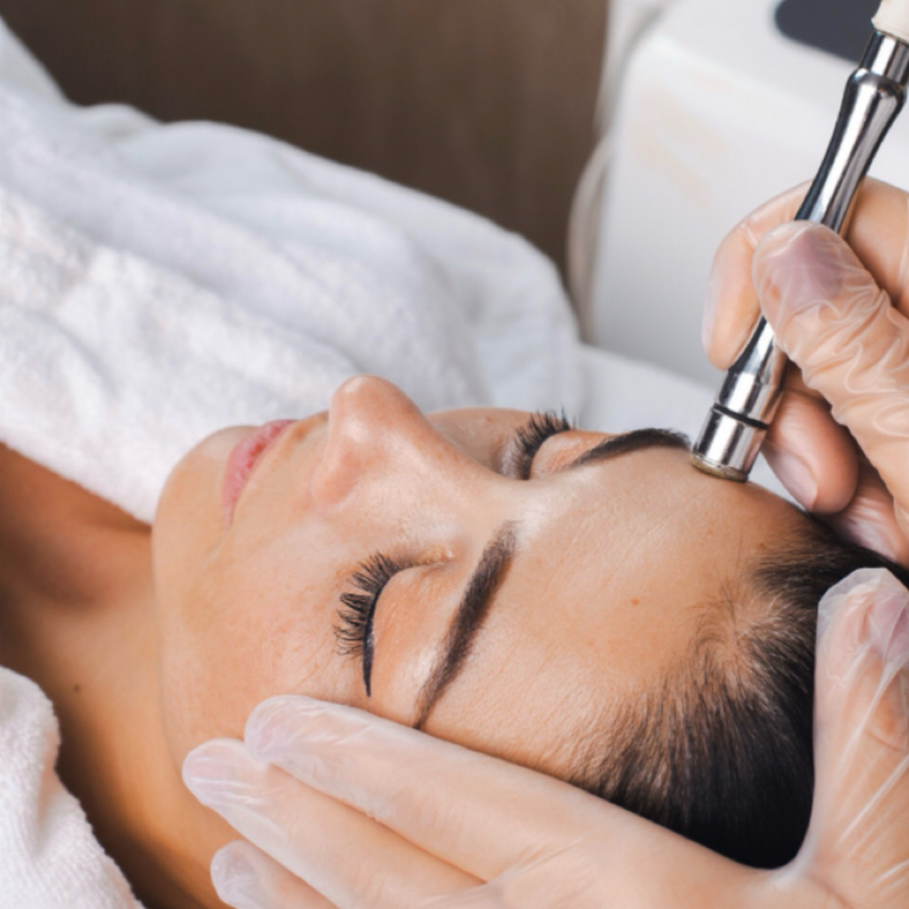 Microdermabrasion💫 at Kiersten  Grisham in Peculiar, MO