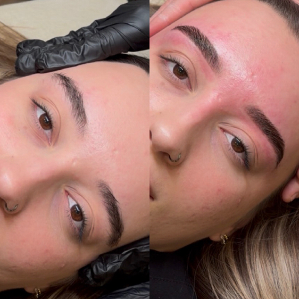 The Aura Lift at Olive and Aura Skin Co. in Greenville, SC