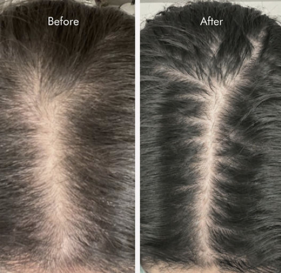 Hair repair treatment