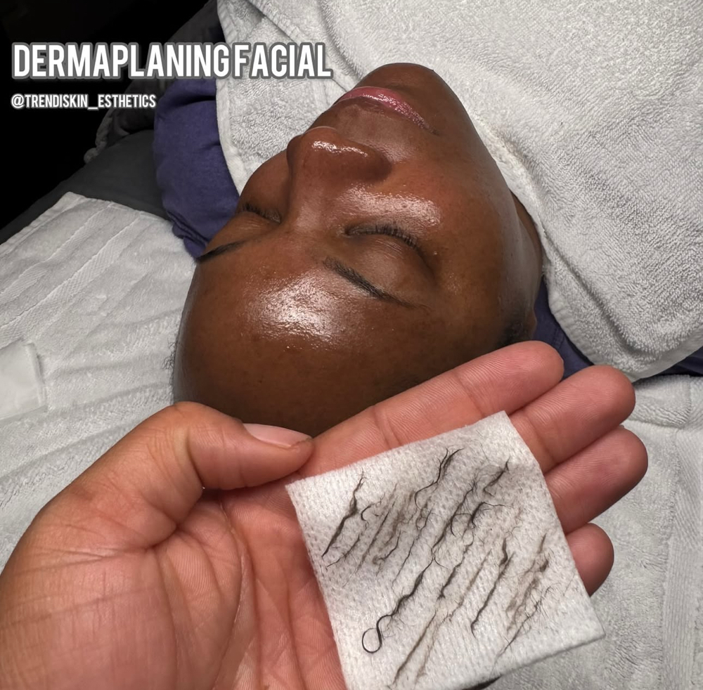 Dermaplaning (8 Weeks)