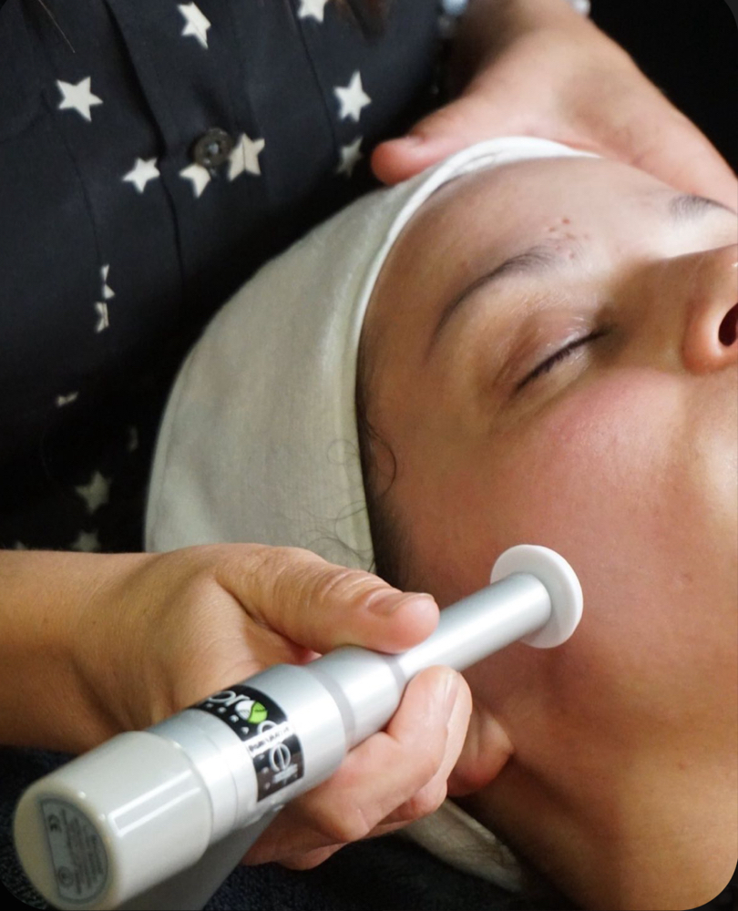 Micro Channeling(Procell Therapies)