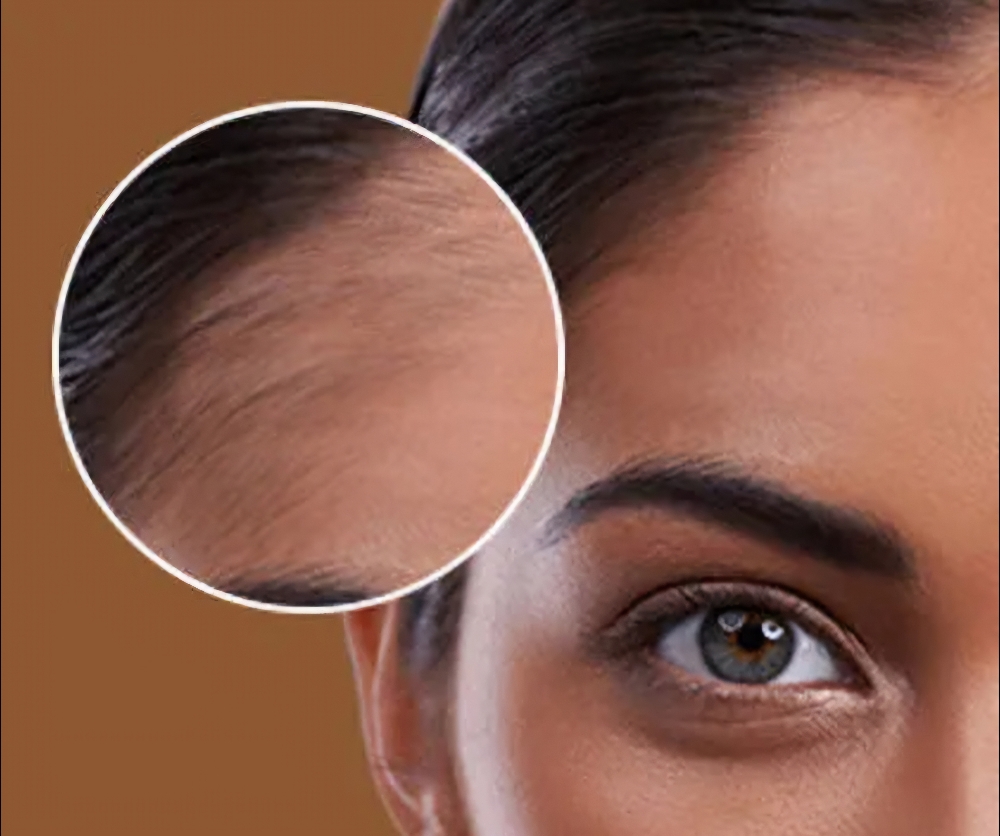 Hairline Clean Up