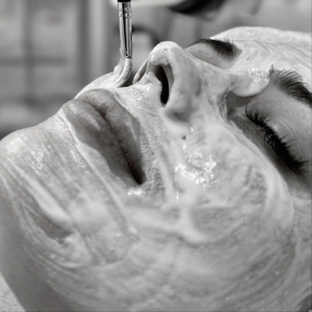 Perfection Chemical peel Experience