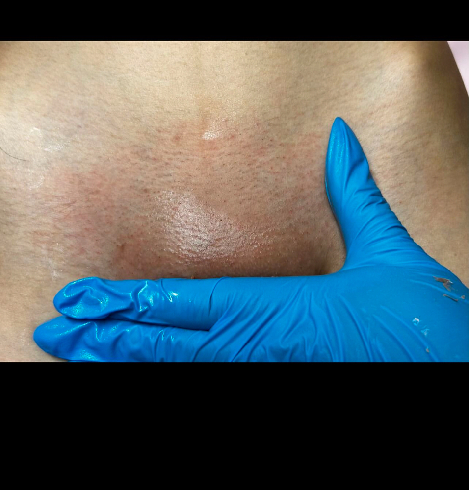 Brazilian Wax