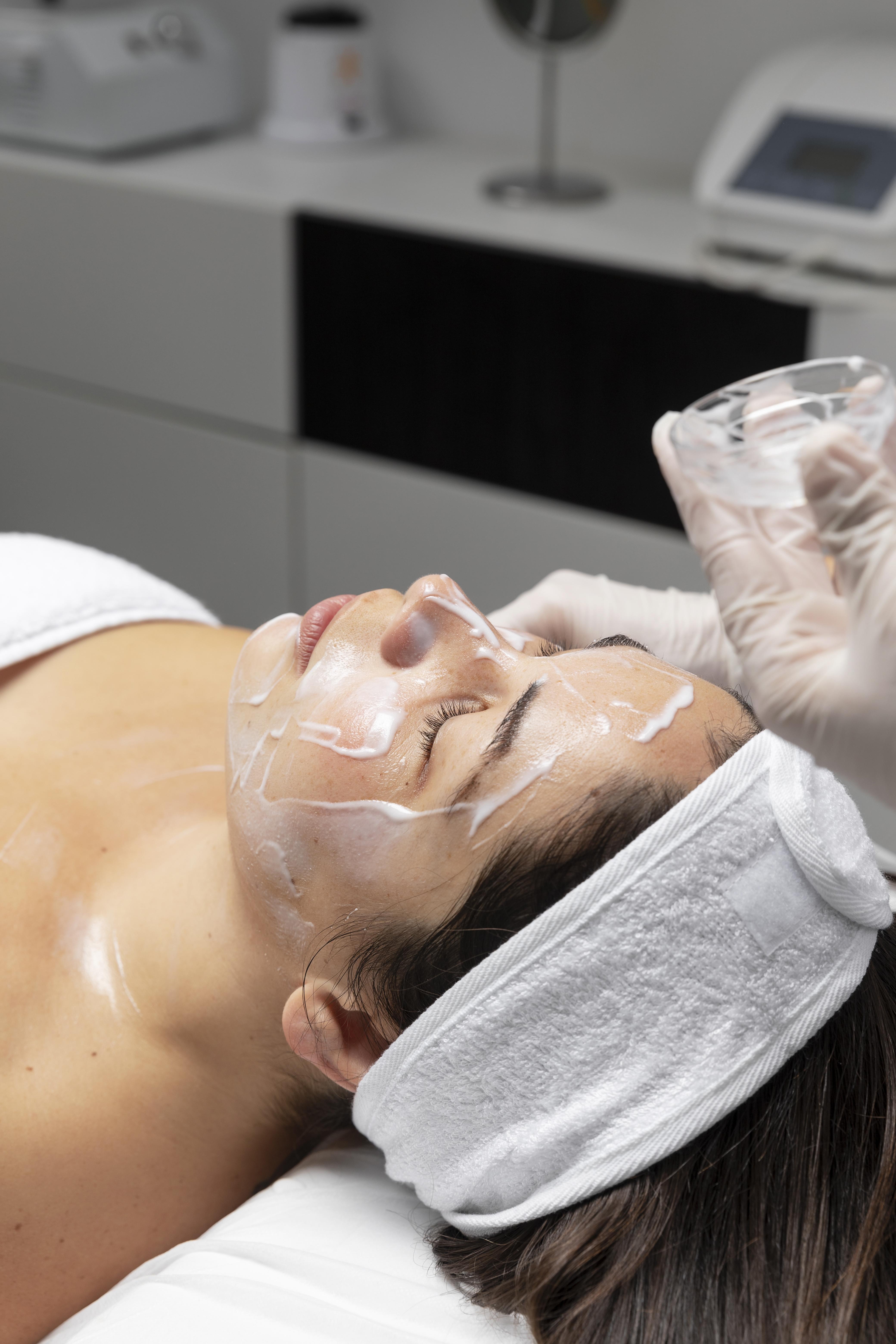 Chemical Peel