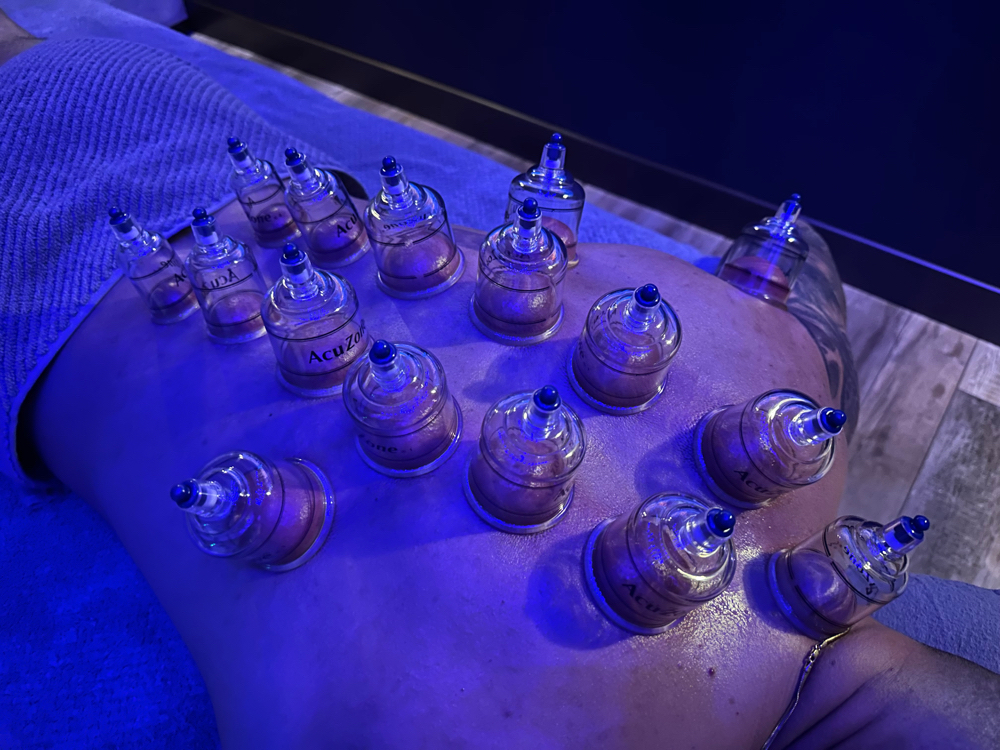 Cupping Massage Therapy - 60 Min