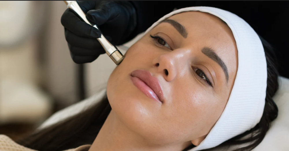 Microdermabrasion at Serene Studios in Sigel, IL