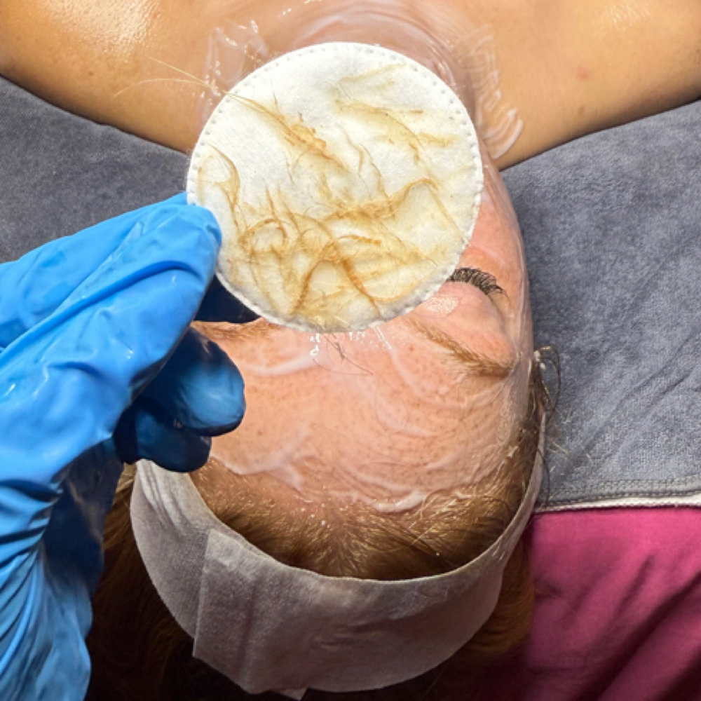 Dermaplane Add On at Fresh Bloom Esthetics in Princeton, IN