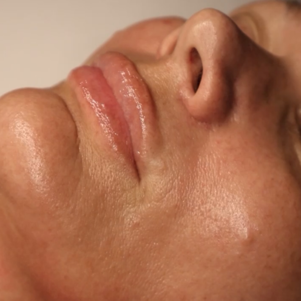 Express Dermaplane Facial at Green Haus Aesthetics in Brentwood, TN
