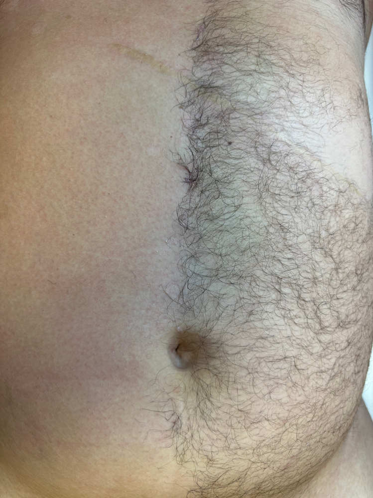 Stomach Wax - Male
