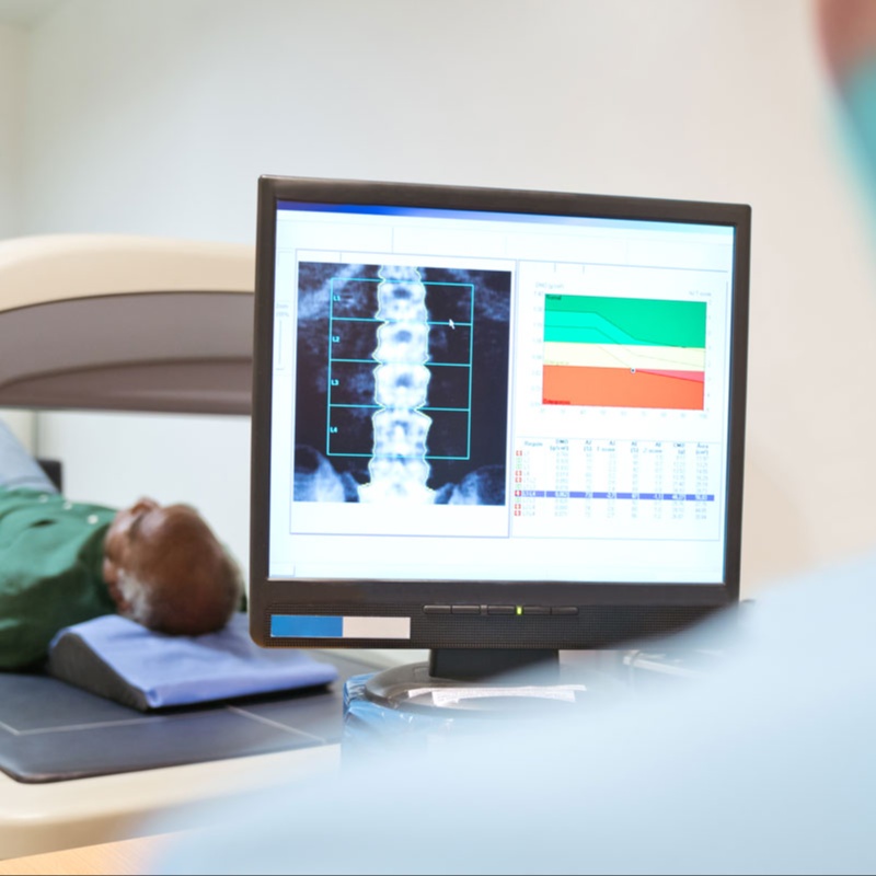 DEXA Body Composition Scan at Brandon Family Chiropractic & Wellness in BRANDON, MS