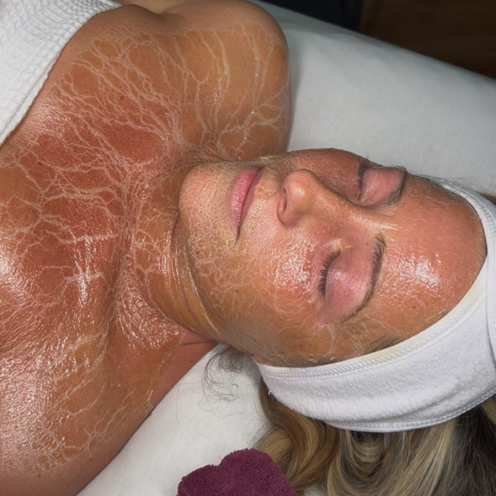 Better Than Botox Facial at THE LAB in Decatur, AL