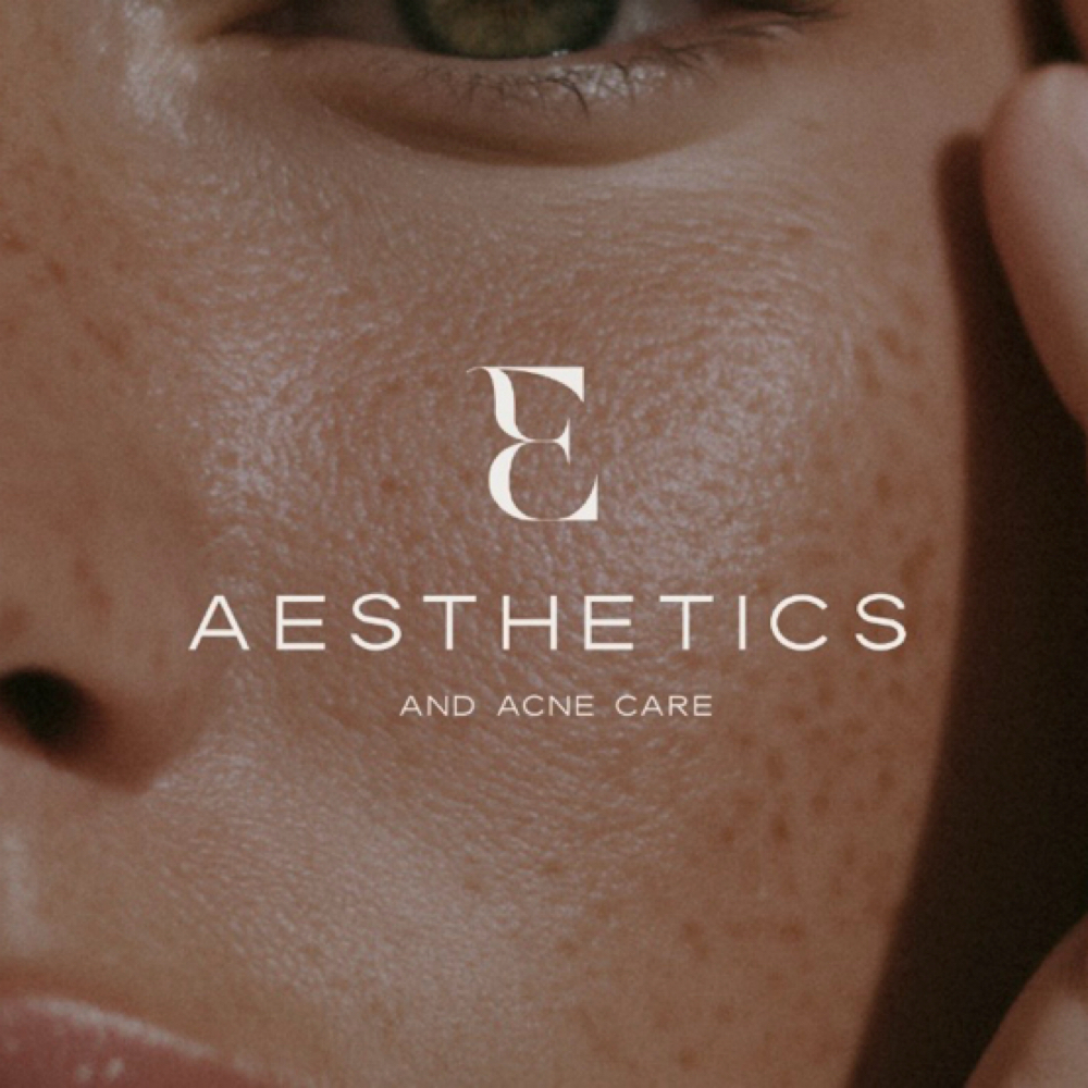 Acne Consultation With Acne Facial