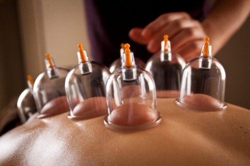 45 Minute Cupping Massage