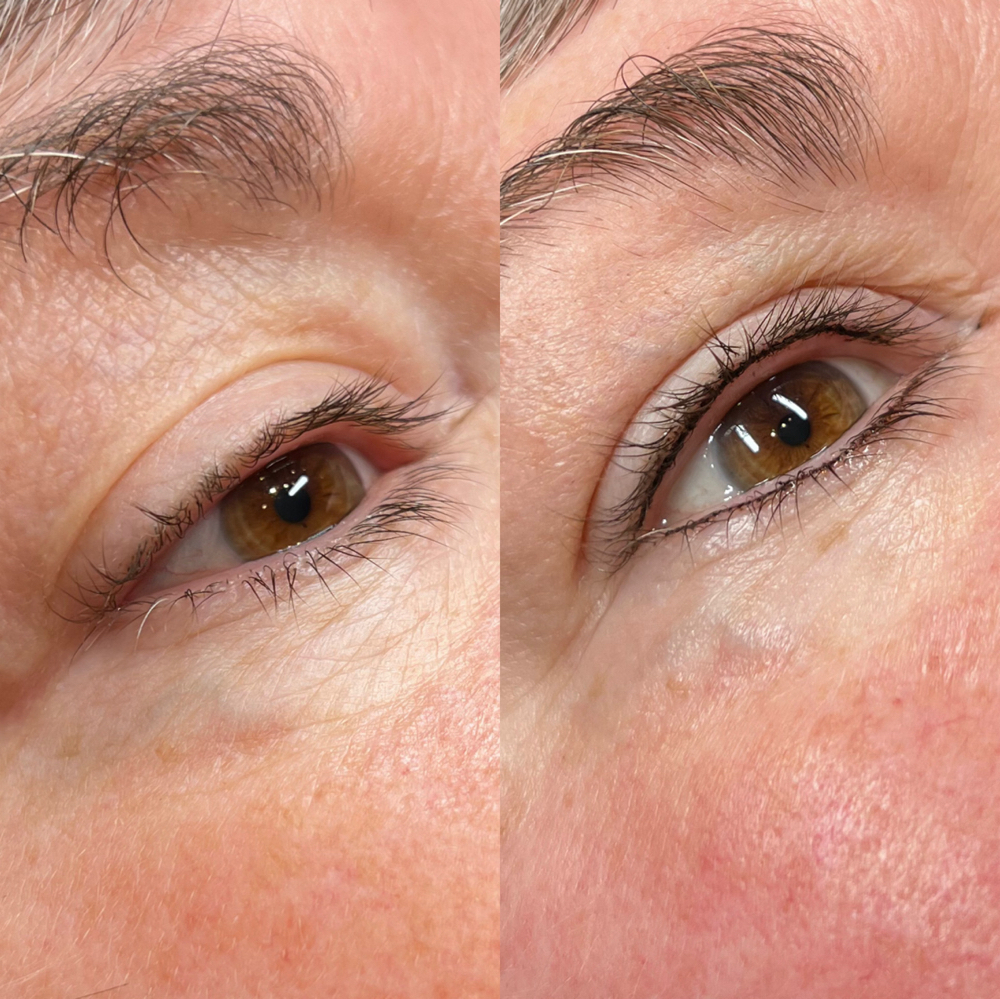 Lash Line Enhancement