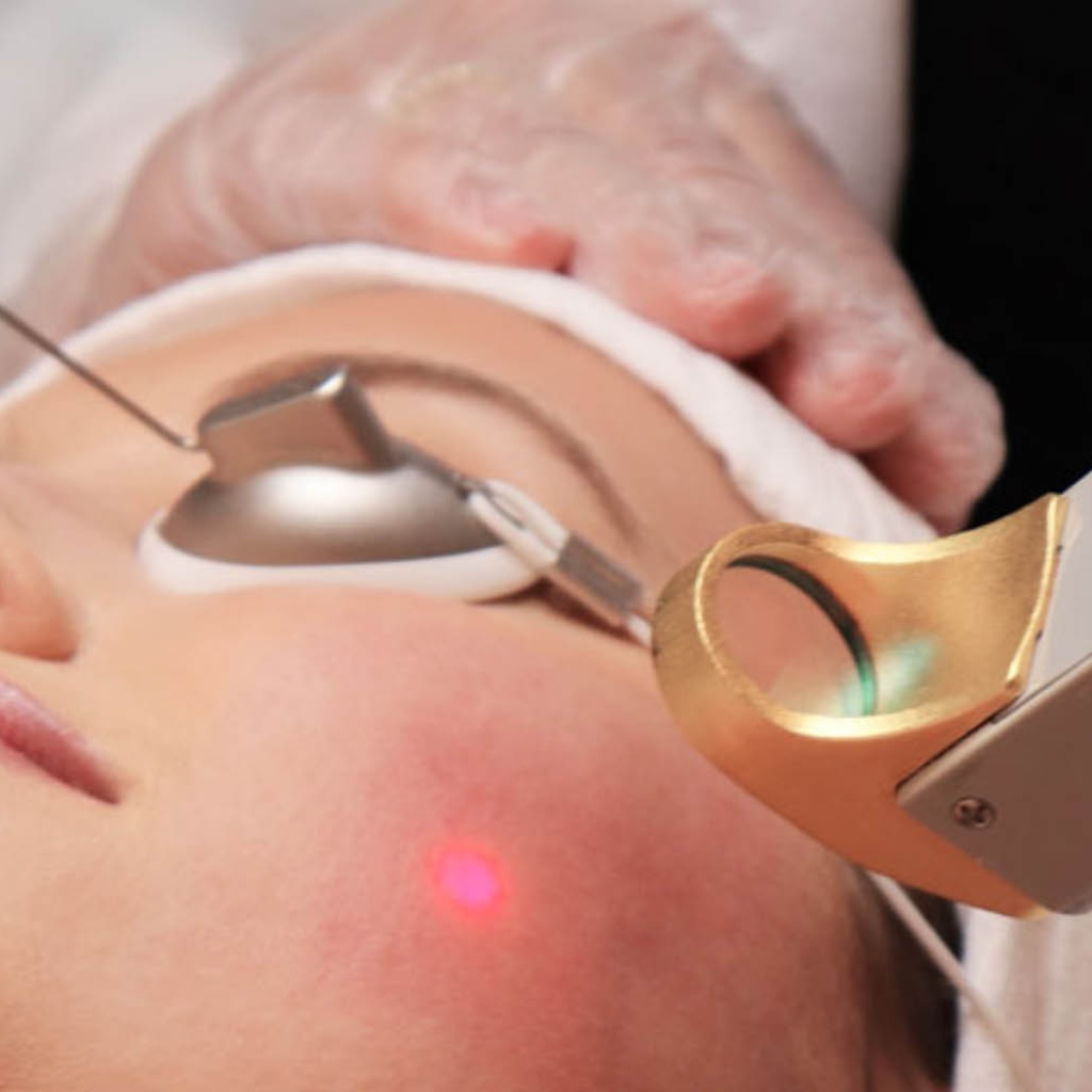 Skin tightening | no downtime at Corrective treatments + professional skincare in Atlanta, GA