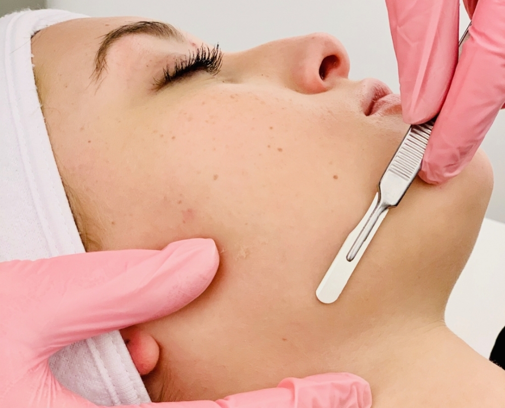 Dermaplane add-on