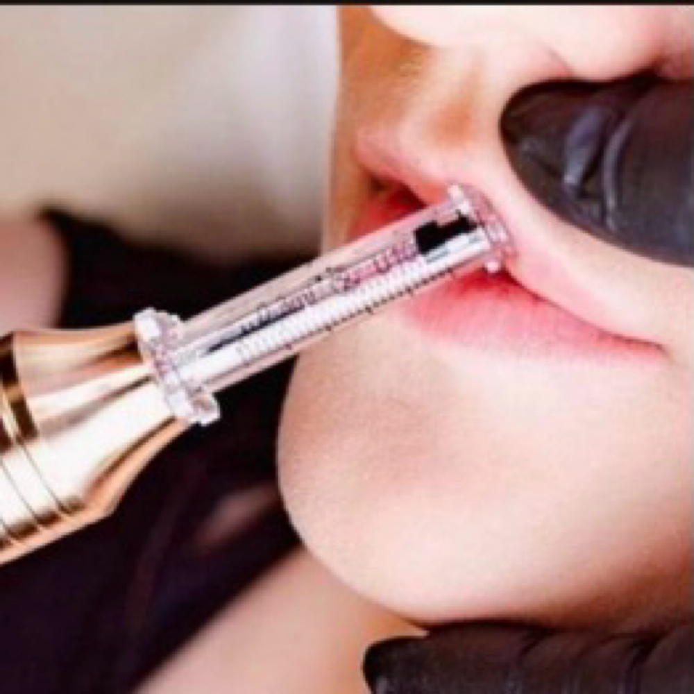 Lip Filler 0.5ML at Mermaid Riot in Lockbourne, OH