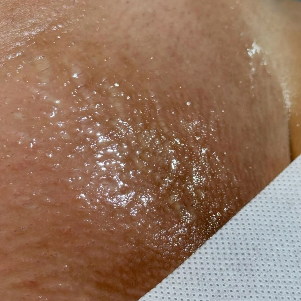 VAJACIAL at Precision skin and Wellness Lab in Tallahassee, FL