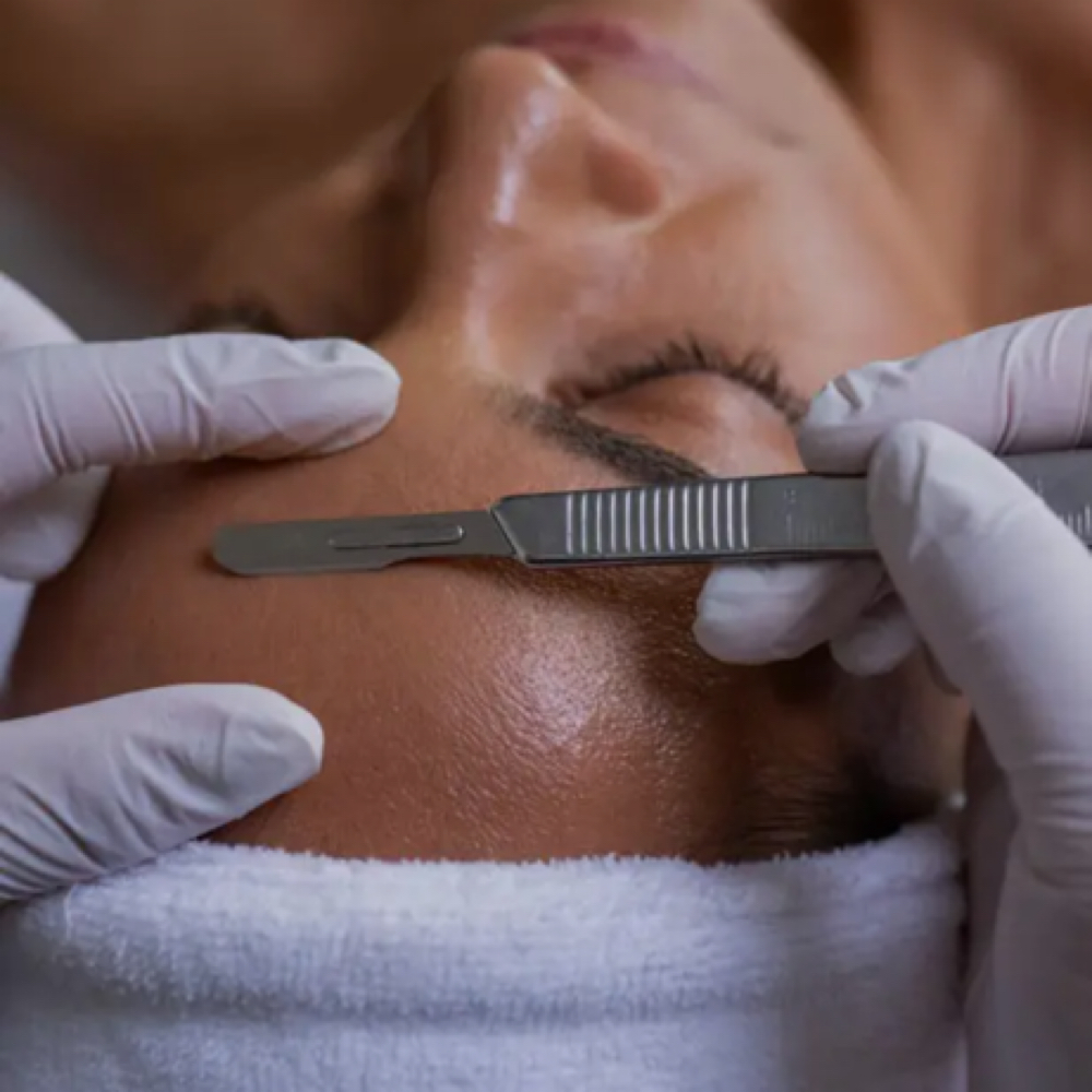 Dermaplane Facial at Bella Shell Spa in Spring Branch, TX