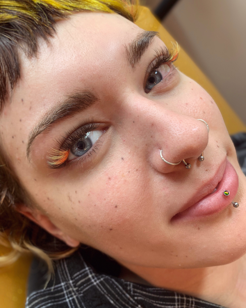 Freckles/beauty Marks