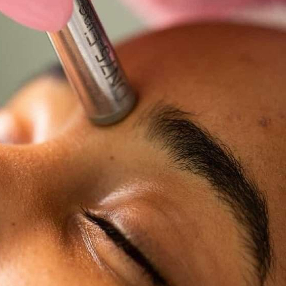 Facial with Microdermabrasion at Étoile Briyan in Malden, MA