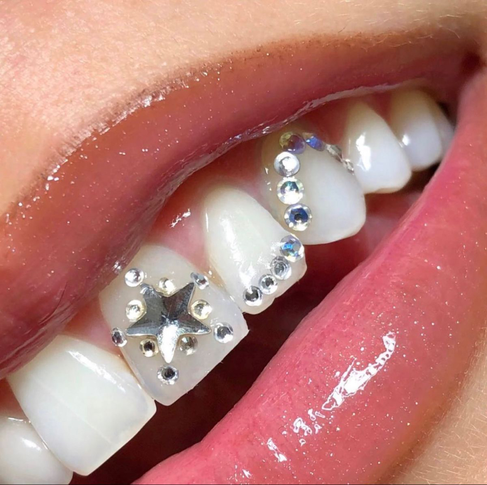Tooth Gem (3)