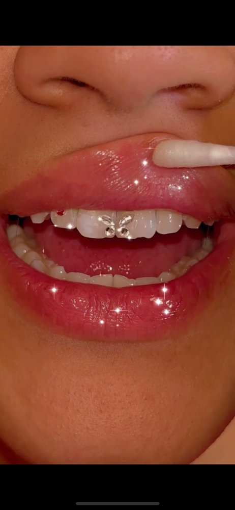 TOOTHGEM