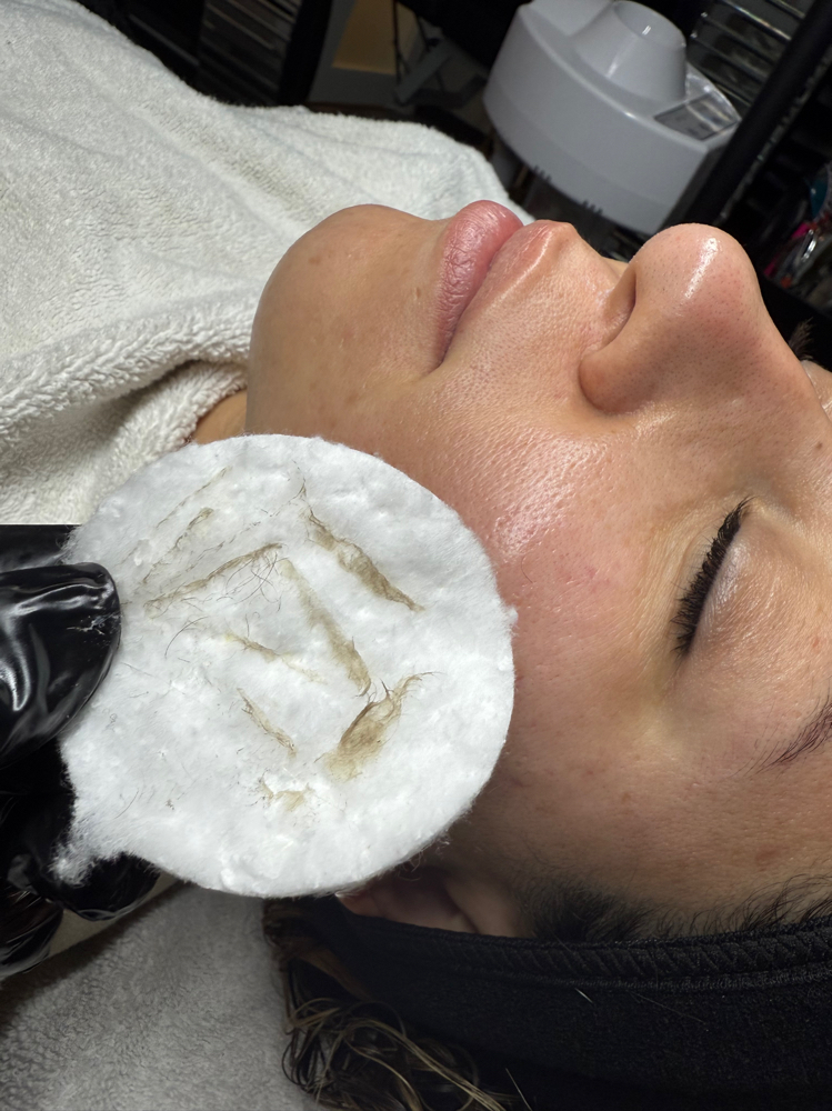 Dermaplane