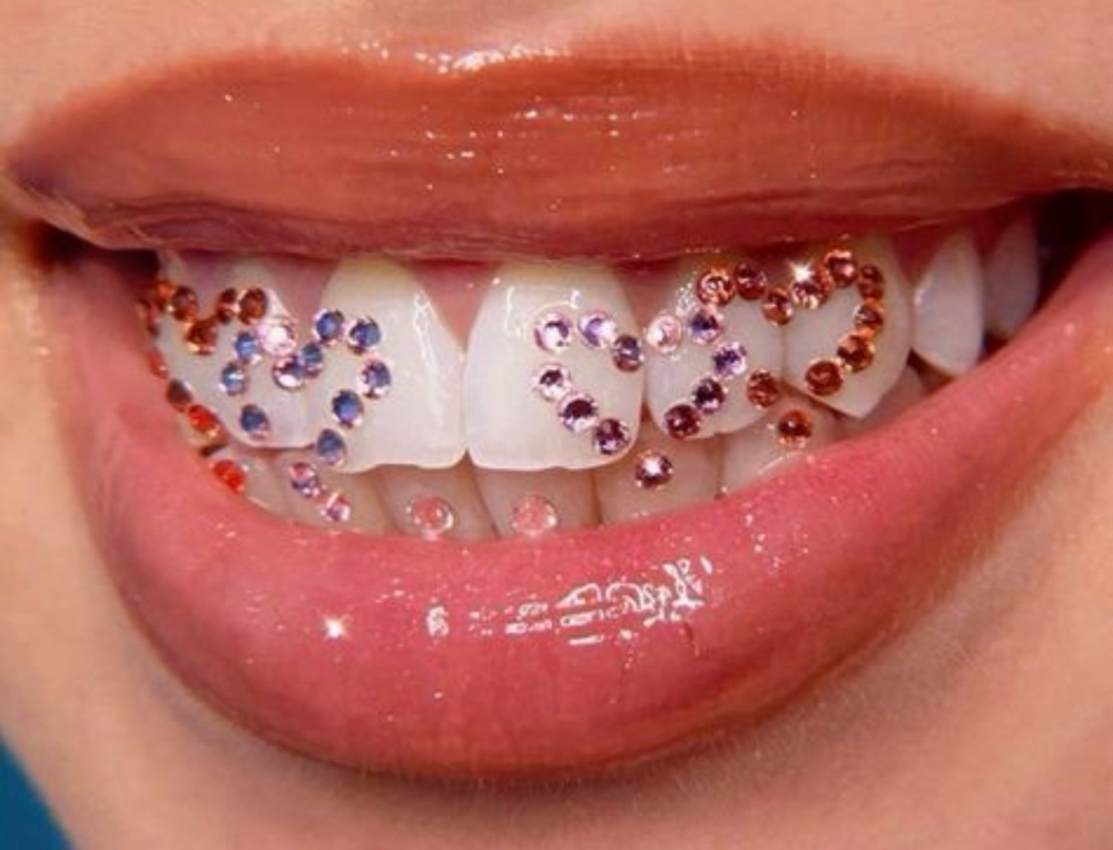 ✨💎Color Pop Gems at 💎Kat’s Tooth Gems💎 in Martinsburg, WV