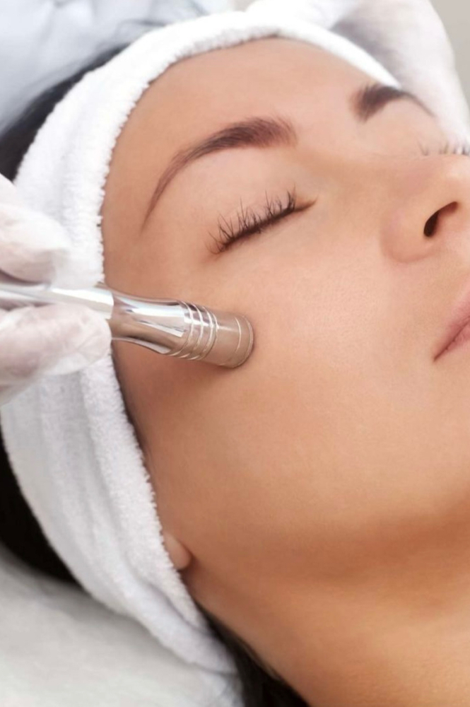 Microdermabrasion