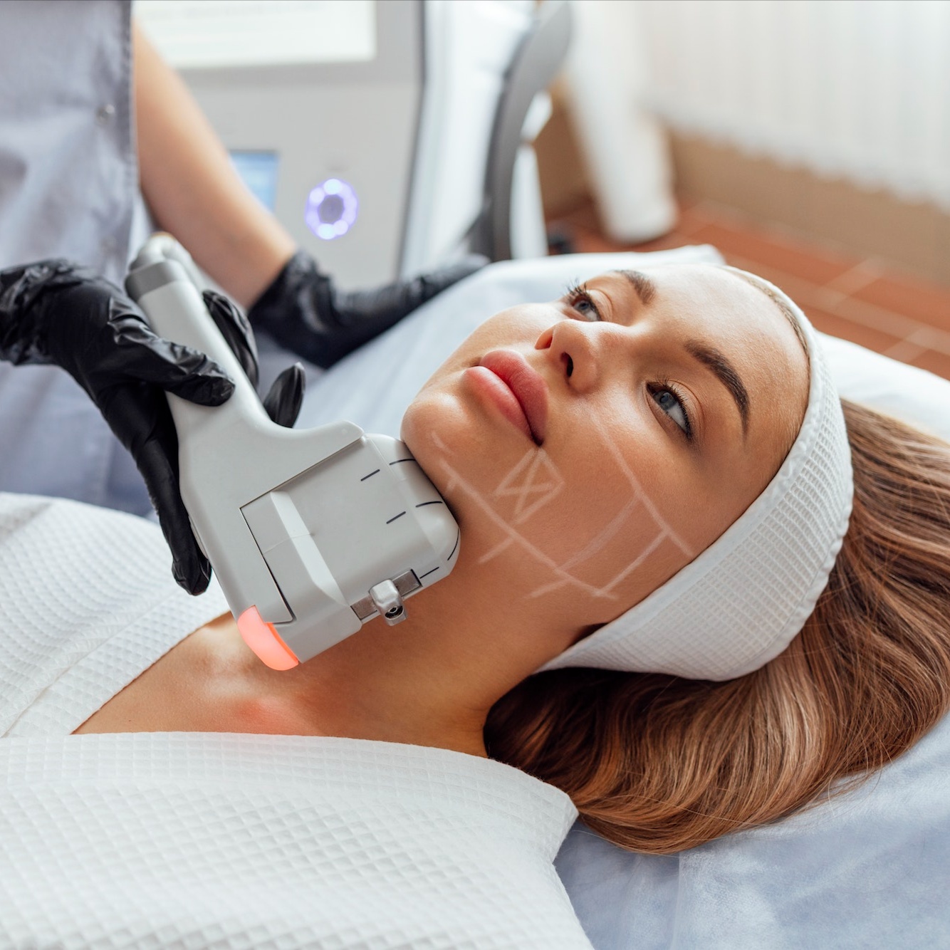 HIFU FACIAL (LIFTING SIN CIRUGIA) at CROWNED BY GRACE  "BEAUTY LOUNGE" in North Bergen, NJ
